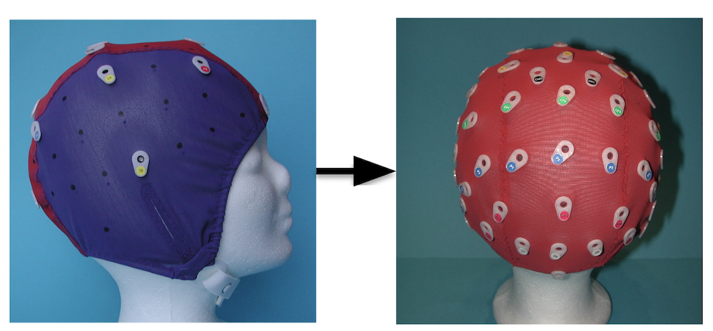 Deep EEG Super-Resolution: Upsampling EEG Spatial Resolution with Generative Adversarial Networks
